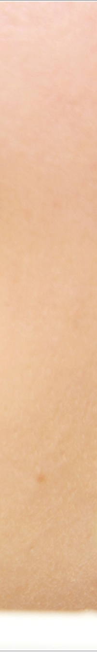 명동라미네이트, 단시간에 환한 미소를 가지고 싶다면? 관련 이미지 14