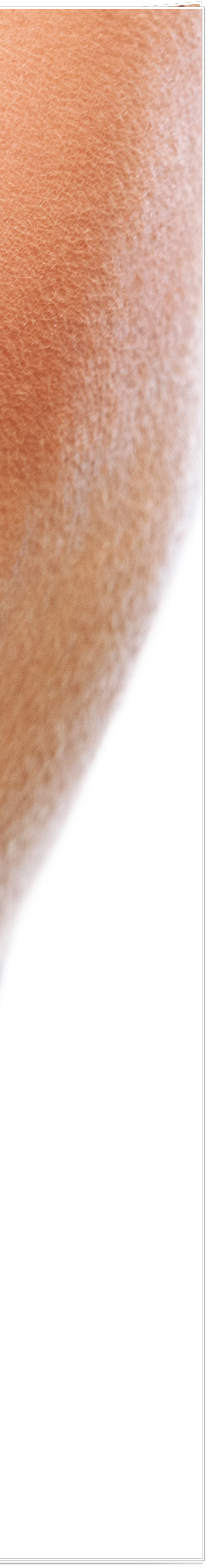 종로치과에서 알려드리는 치아미백과 라미네이트의 모든 것 관련 이미지 19