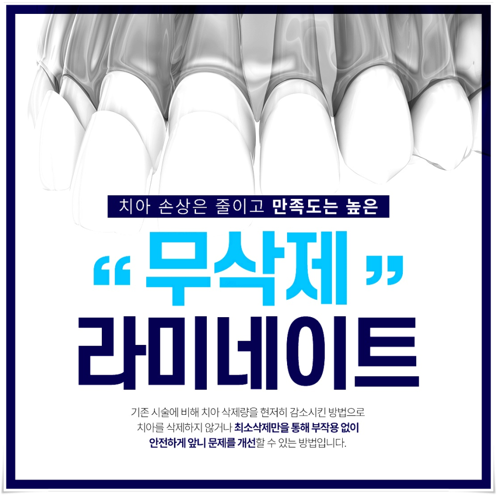 Laminate Veneers Explained by Jonggak Station Dental Clinic: Treatment Duration, Candidates, Benefits, and Everyday Changes image 3