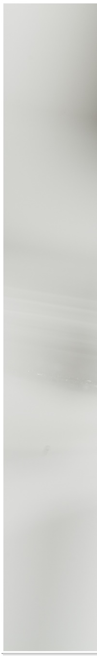 광화문역치과 생활습관에 따른 맞춤형 미백 관리 관련 이미지 6