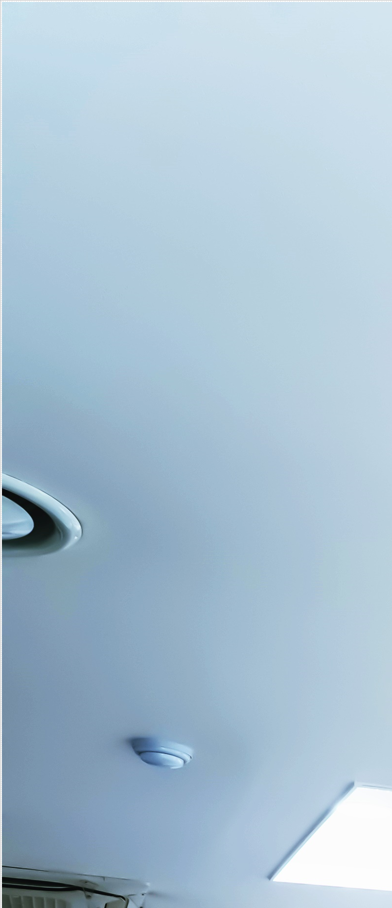 종각역치과 임플란트 치료, 이것만은 알고 계세요! 관련 이미지 35