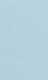 명동치과 라미네이트와 올세라믹의 차이점 관련 이미지 37