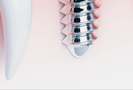 종로임플란트 건강한 치아를 위한 현명한 선택 관련 이미지 27