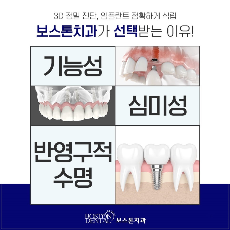 종로임플란트 만족도를 높이기 위해서는 관련 이미지 6