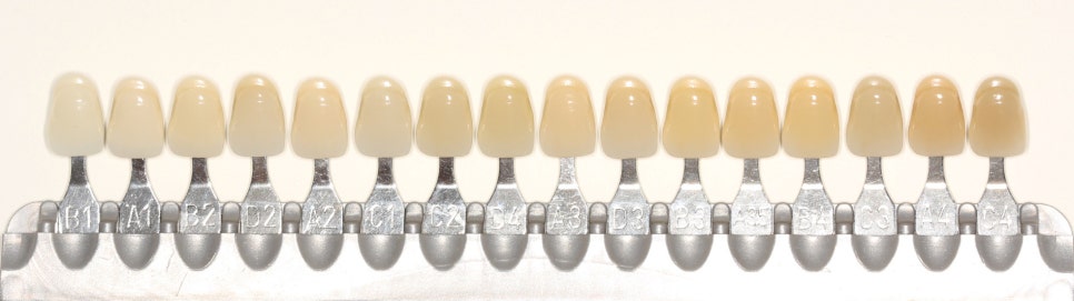 종각역치과, 치아미백 후 48시간을 주의하라! 관련 이미지 6