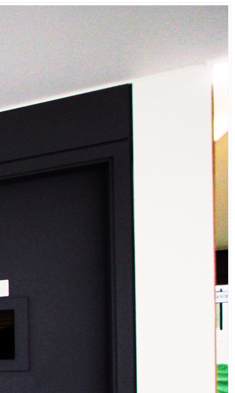 종로치과 인비절라인 해야 하는 이유 관련 이미지 31