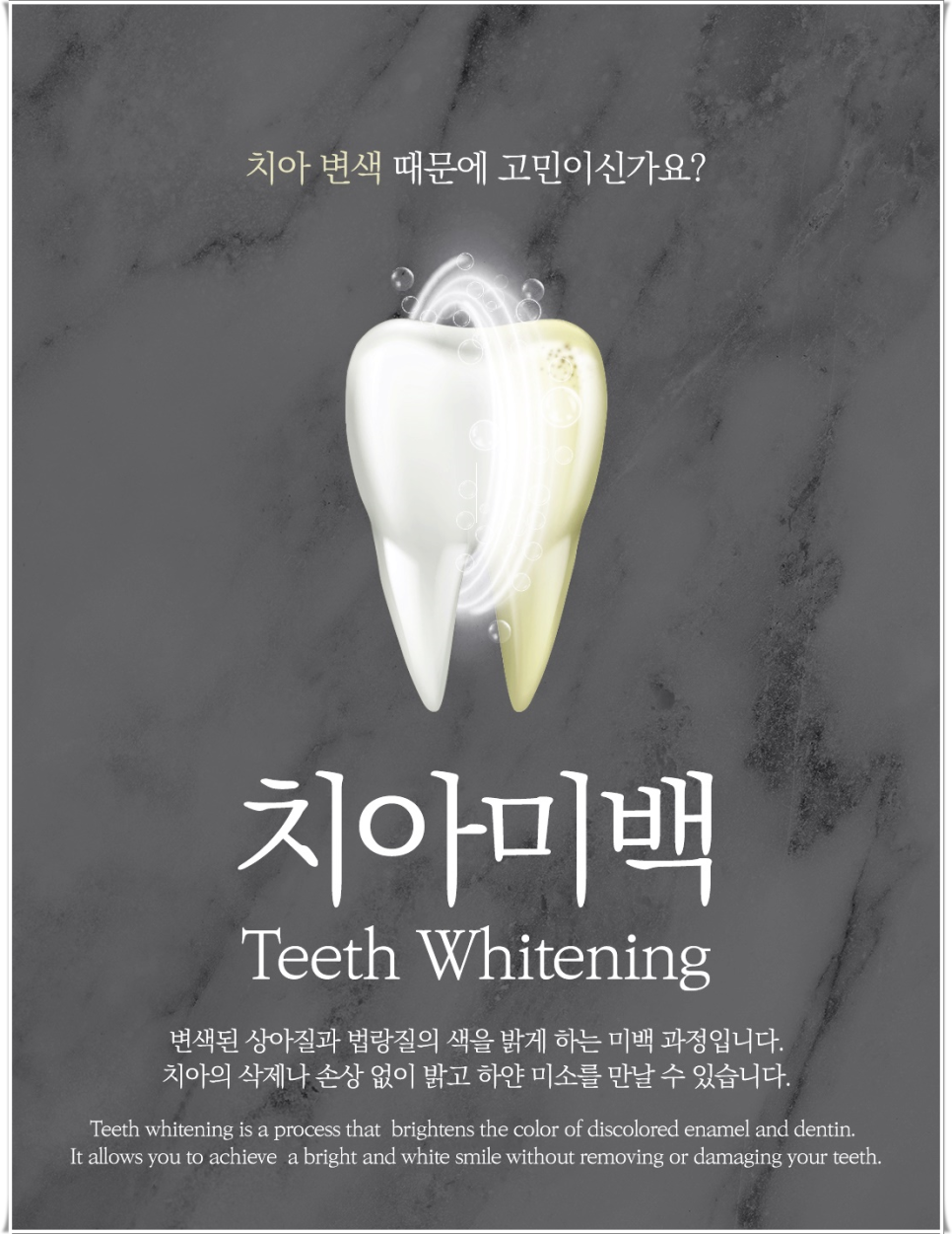 을지로입구역치과에서 알려드리는 치아미백과 라미네이트의 모든 것 관련 이미지 2