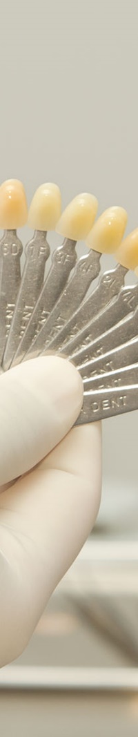 을지로입구역치과 치아미백으로 하얀 미소 찾기 관련 이미지 12