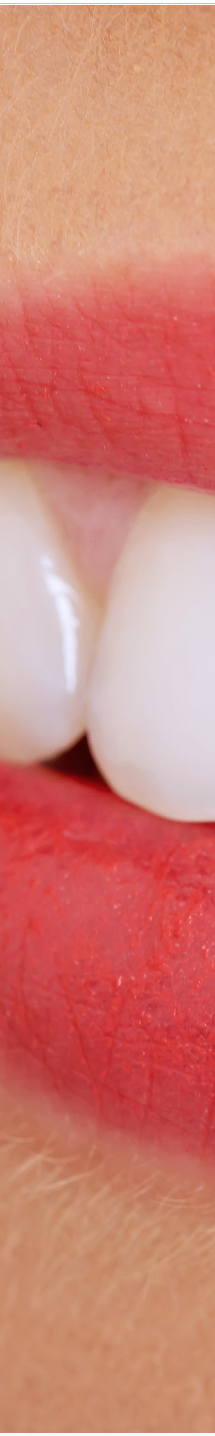 종로3가치과에서 알려드리는 무삭제 라미네이트 완벽 가이드 관련 이미지 12