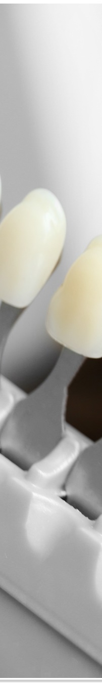 광화문역치과 생활습관에 따른 맞춤형 미백 관리 관련 이미지 27