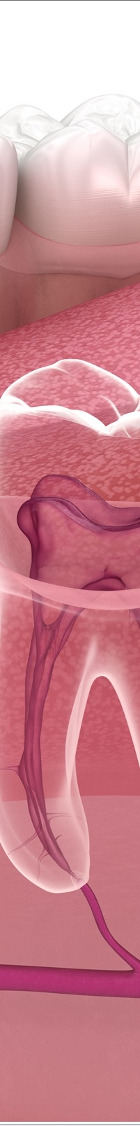 종각역치과 자연치아를 살리기 위한 대책, 신경치료 관련 이미지 14