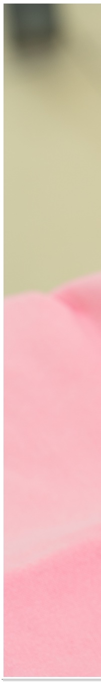 광화문역치과 생활습관에 따른 맞춤형 미백 관리 관련 이미지 16