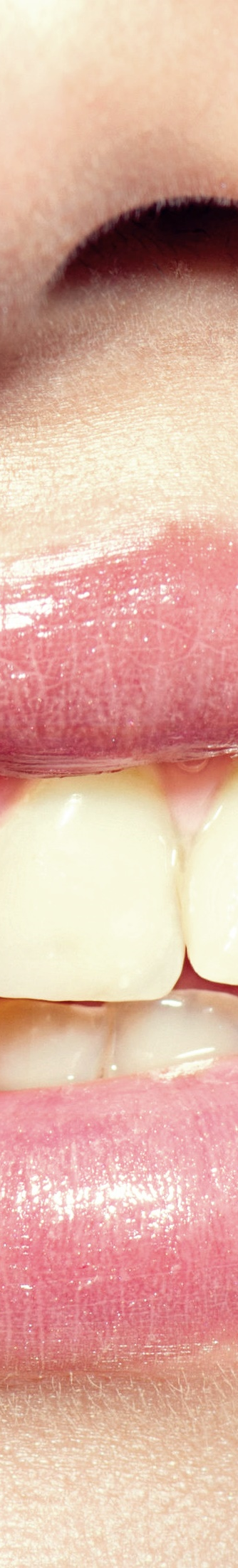 광화문역치과 치아미백과 라미네이트의 차이는? 관련 이미지 8