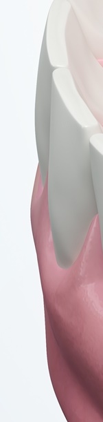 종로치과추천 나이별 &middot; 상황별 임플란트 치료 방법 관련 이미지 31