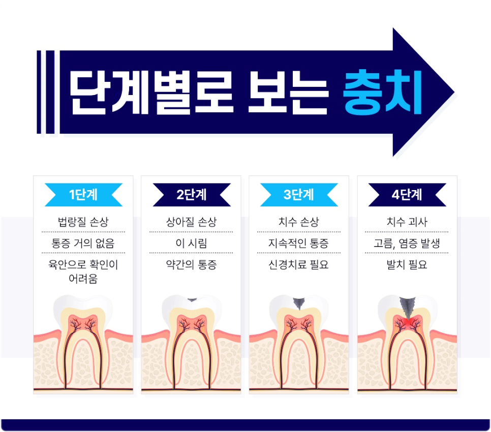 광화문역치과 신경치료 과정이 궁금해요 관련 이미지 3