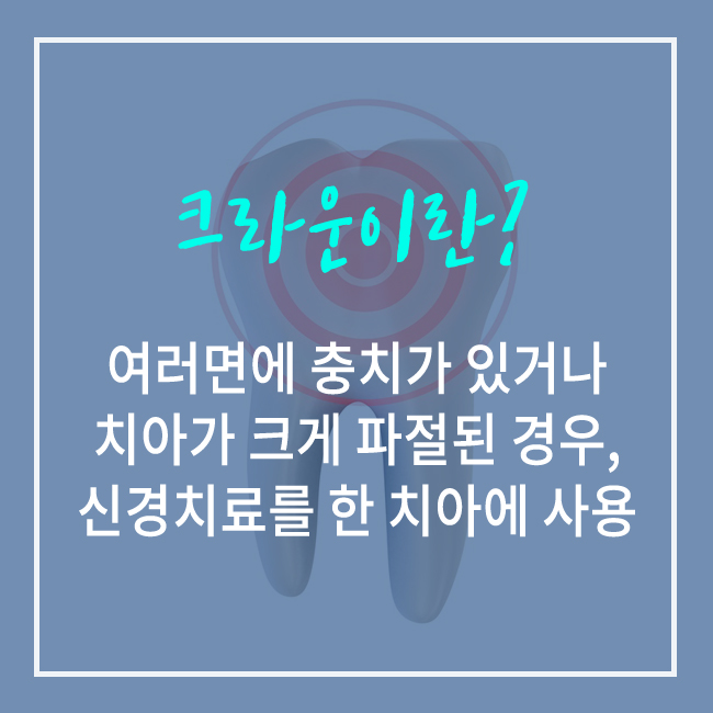 종각역 충치치료 꼼꼼하게~ 관련 이미지 5