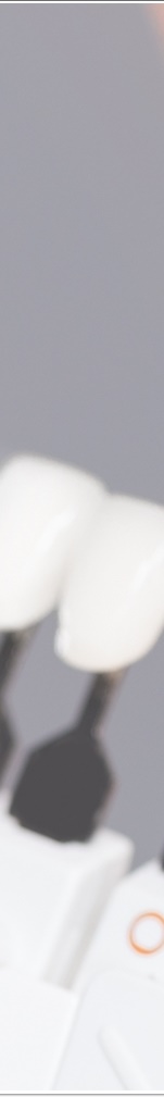 광화문치과 라미네이트 치료 전 고민해야 할 것 관련 이미지 25