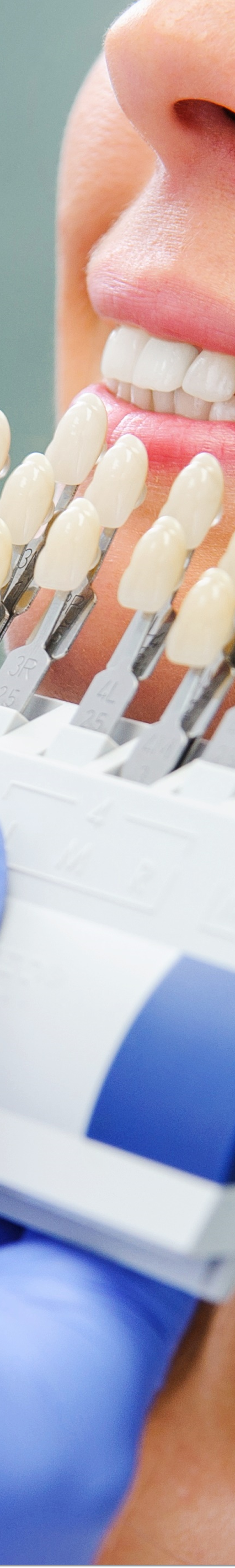 광화문역치과 라미네이트 치료가 궁금해요 관련 이미지 35