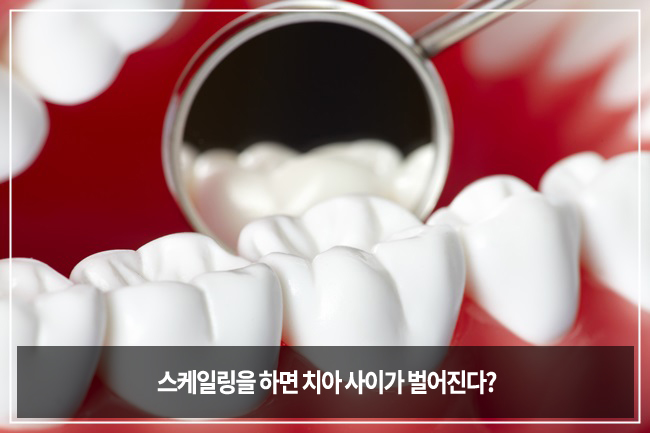 스케일링에 대한 잘못된 상식 관련 이미지 4