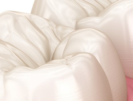 종각치과 너무 많은 치과 치료가 헷갈린다면? 관련 이미지 27