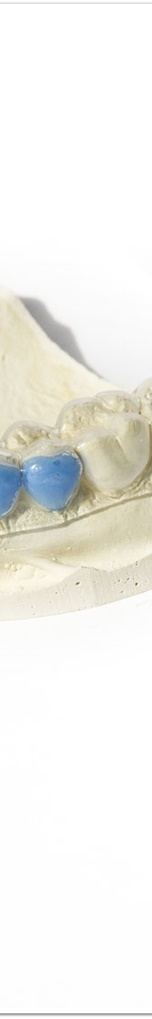 명동역치과 치아 미백, 궁금했던 모든 것 - 오해와 진실 관련 이미지 17