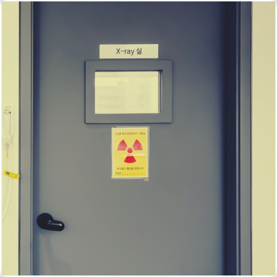 을지로입구역치과 오래 사용 가능한 임플란트 관련 이미지 23