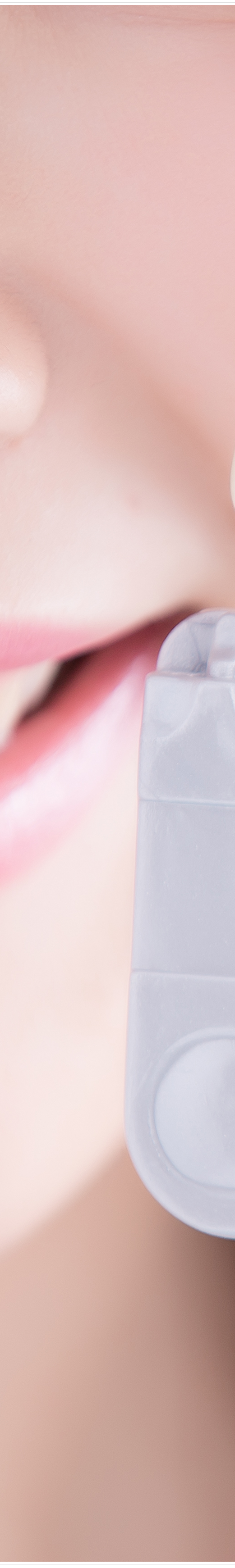 명동치과 라미네이트로 환하게 스마일~ 관련 이미지 12