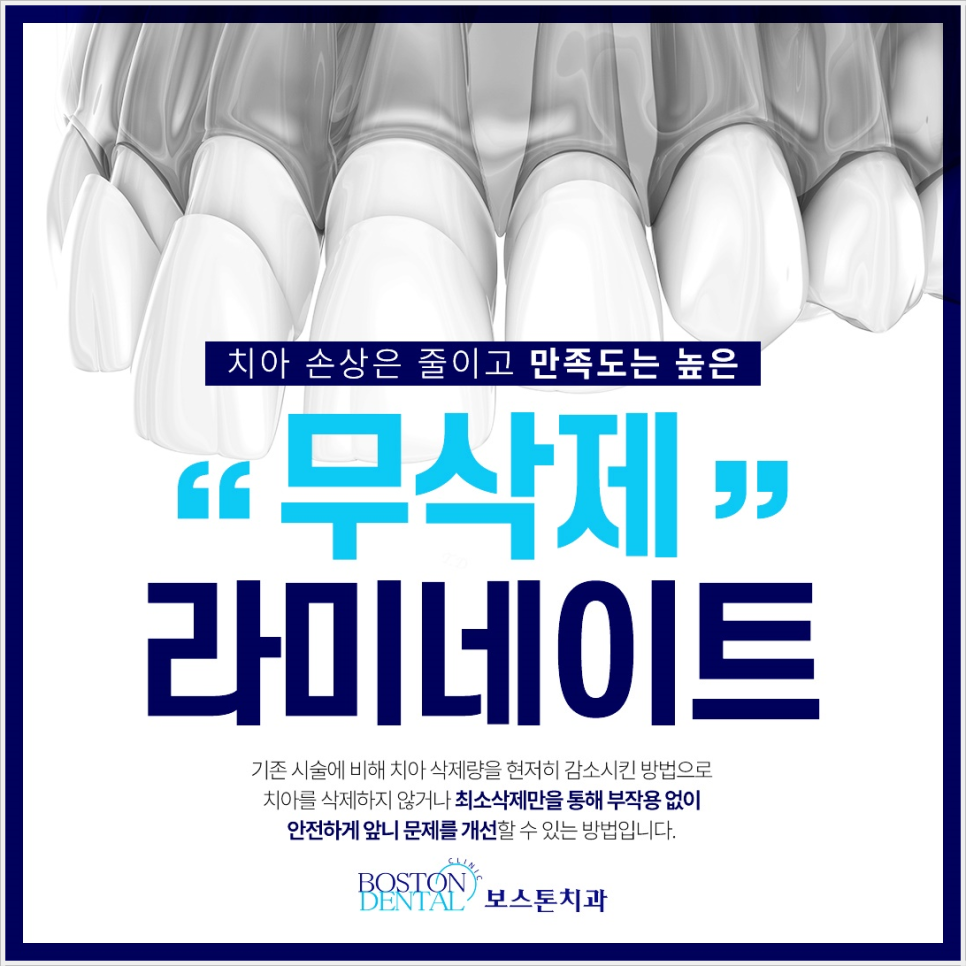 종로치과 자연스러운 미소 이제는 걱정없어요 관련 이미지 4