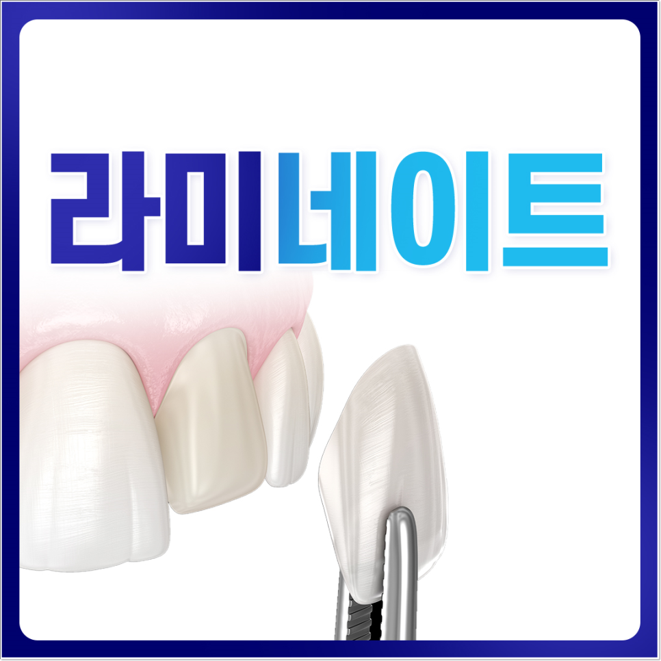 명동라미네이트, 단시간에 환한 미소를 가지고 싶다면? 관련 이미지 1