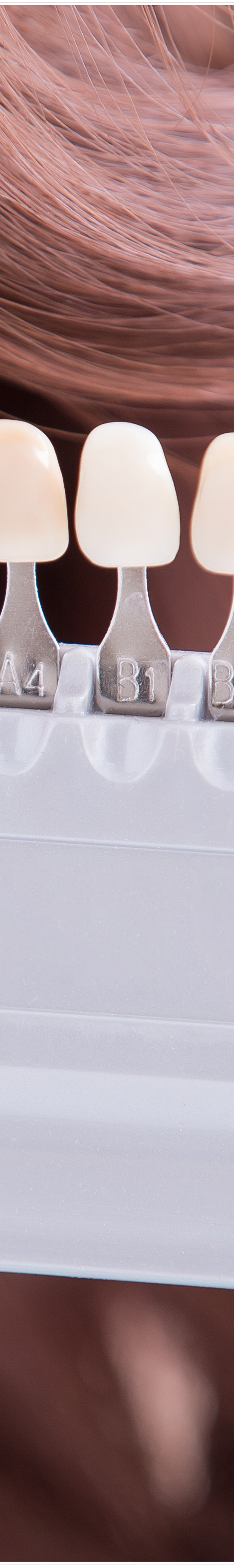 명동치과 라미네이트로 환하게 스마일~ 관련 이미지 15