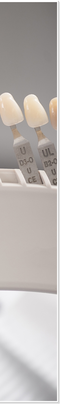 광화문역치과 치아미백과 라미네이트 나에게 필요한 건? 관련 이미지 24