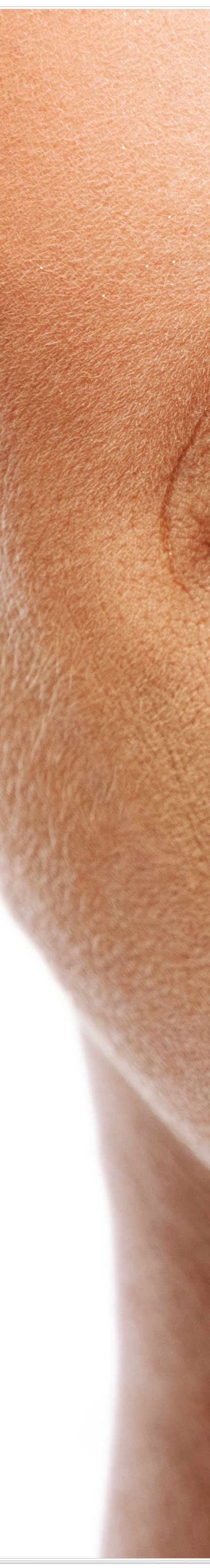 종로치과에서 알려드리는 치아미백과 라미네이트의 모든 것 관련 이미지 11