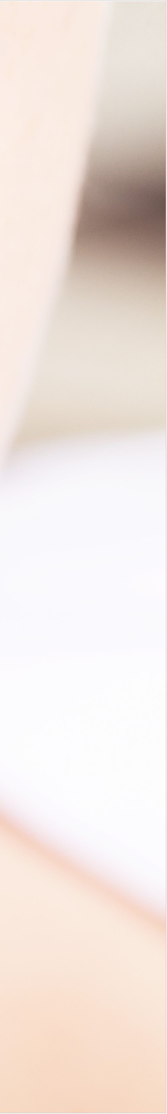 을지로입구역치과에서 알려드리는 치아미백과 라미네이트의 모든 것 관련 이미지 16