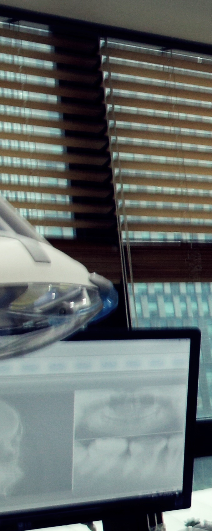 종로구치과 임플란트 하고 끝? 관리까지 잘해줘야 하는 이유 관련 이미지 30