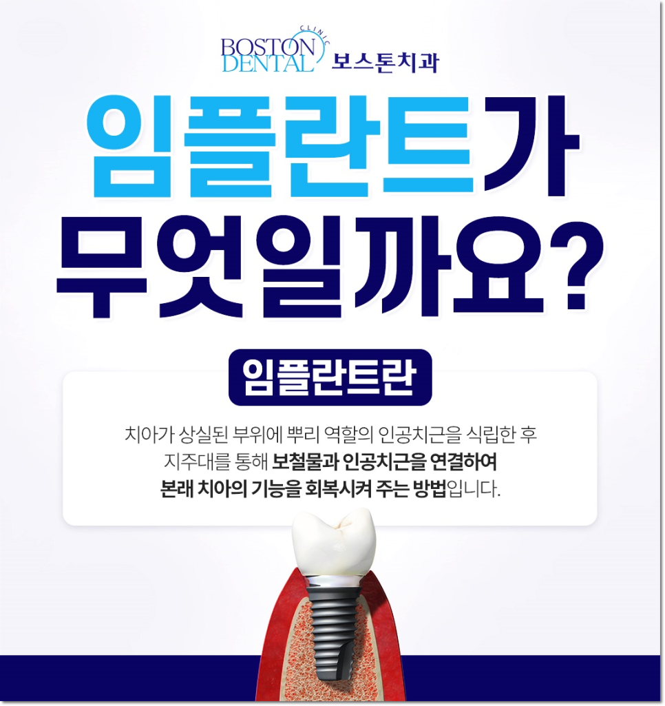 명동치과 상실부위는 임플란트로 관련 이미지 2