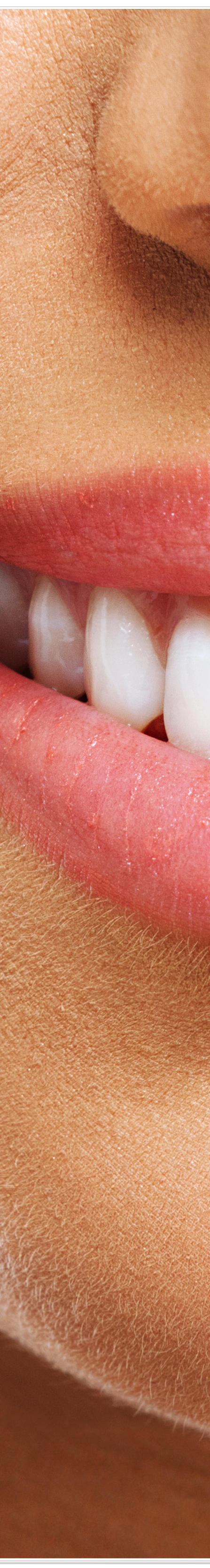 종로치과에서 알려드리는 치아미백과 라미네이트의 모든 것 관련 이미지 13