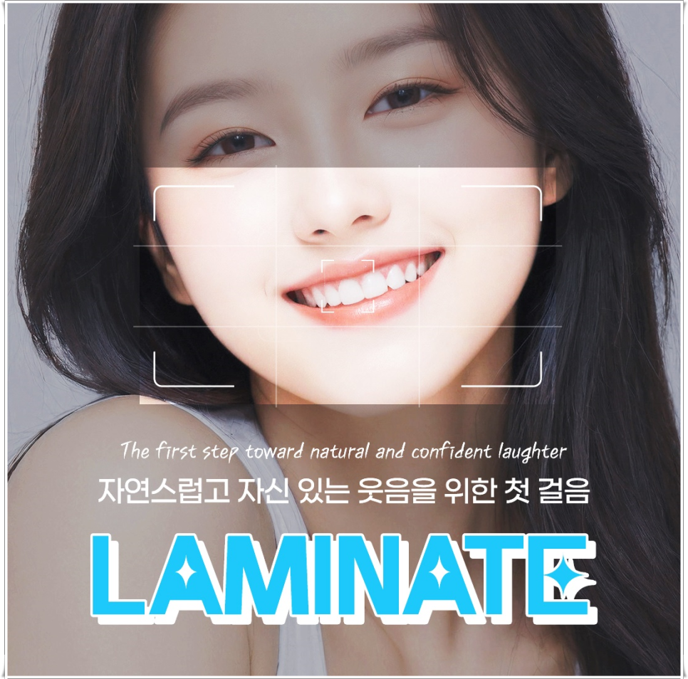 라미네이트 유지기간, 오래 사용하는 관리 방법 총정리 | 종로치과 관련 이미지 1