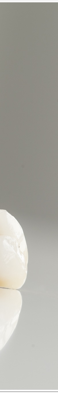 명동역치과 치아 미백, 궁금했던 모든 것 - 오해와 진실 관련 이미지 30