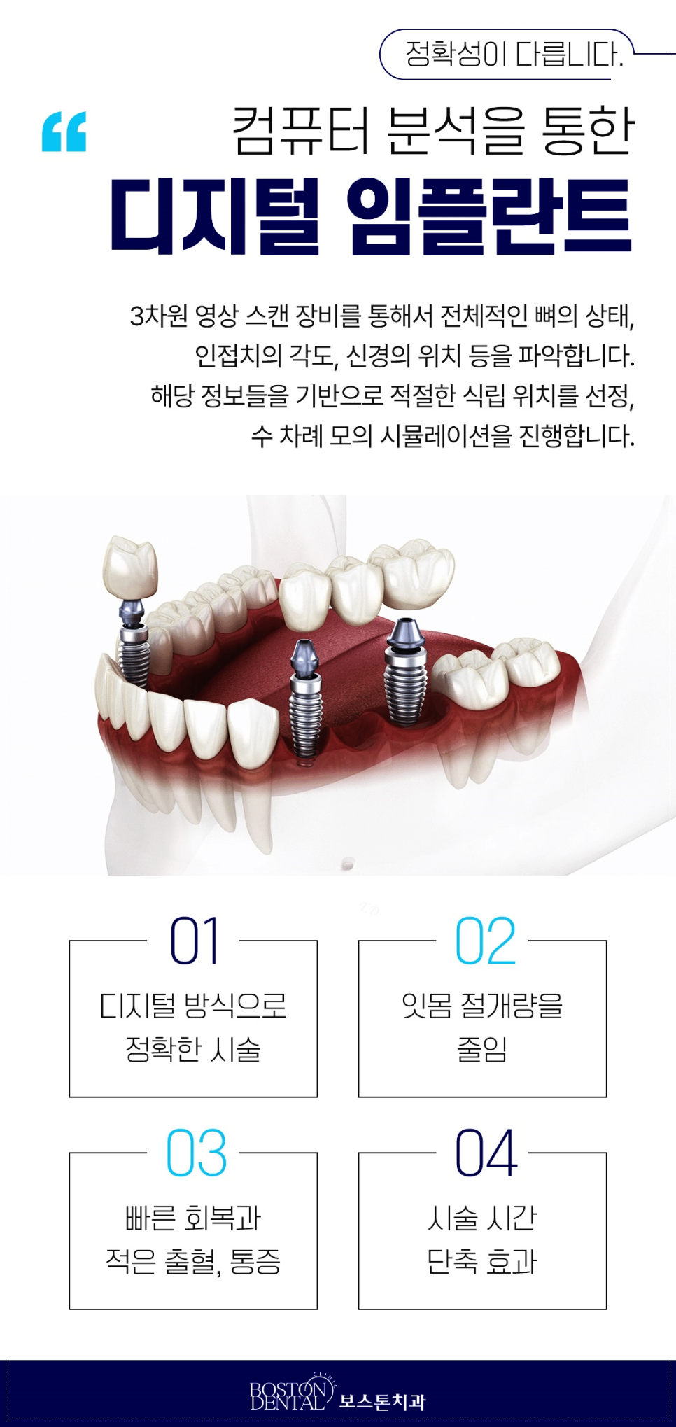 종각치과 빈 공간을 알맞게 해결합니다. 관련 이미지 6