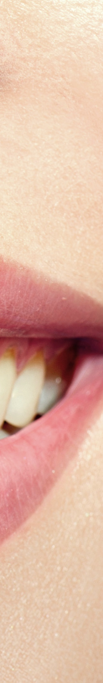 광화문역치과 치아미백과 라미네이트의 차이는? 관련 이미지 10