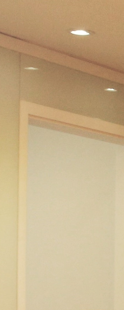 종로구치과 임플란트 하고 끝? 관리까지 잘해줘야 하는 이유 관련 이미지 11