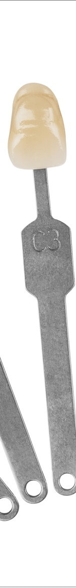 광화문치과 라미네이트 치료 전 고민해야 할 것 관련 이미지 7