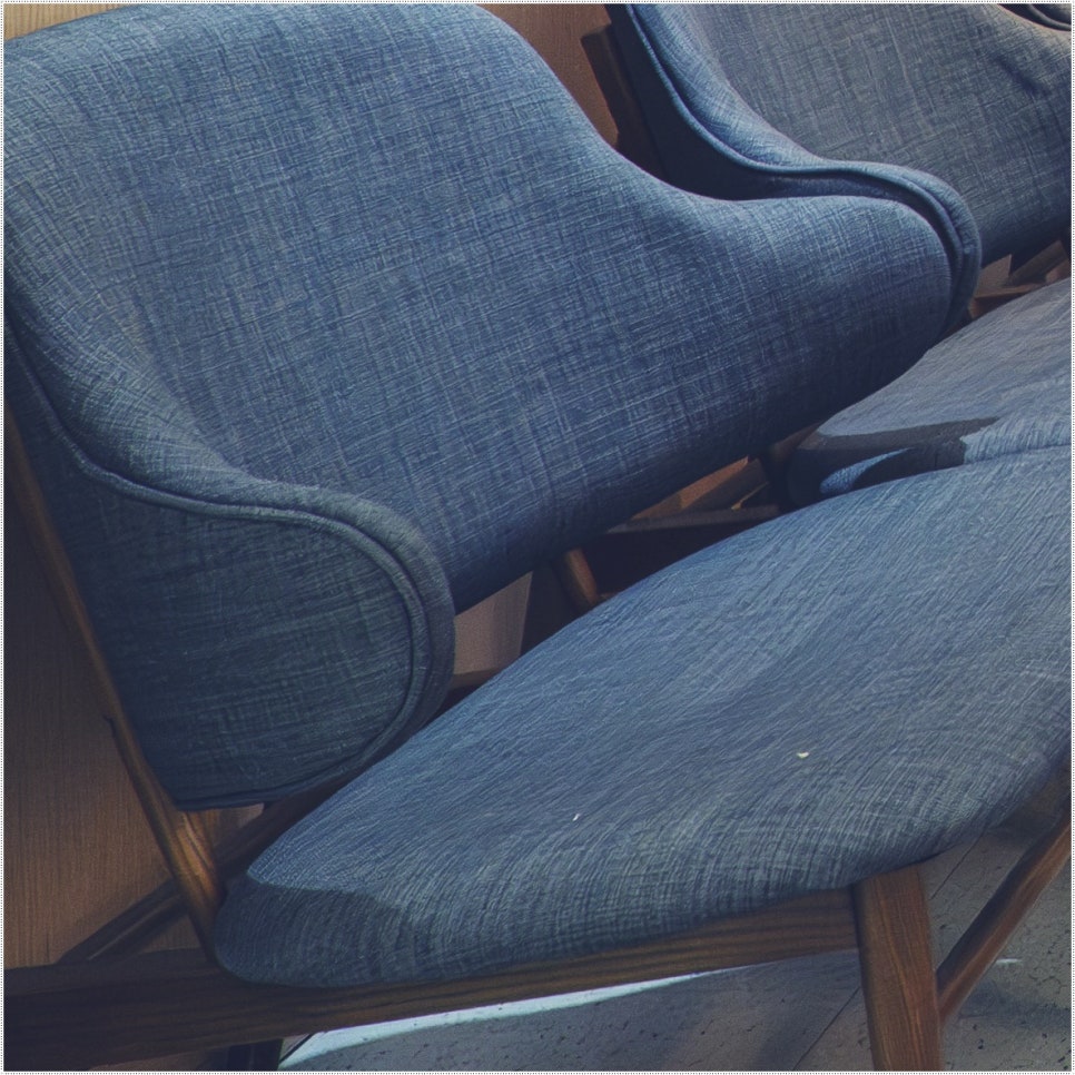 종각치과 임플란트 하나를 심더라도 신중하게 관련 이미지 31