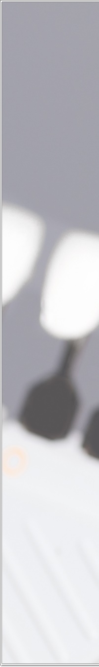 명동치과 치아 라미네이트의 모든 것: 앞니부터 어금니까지 관련 이미지 17