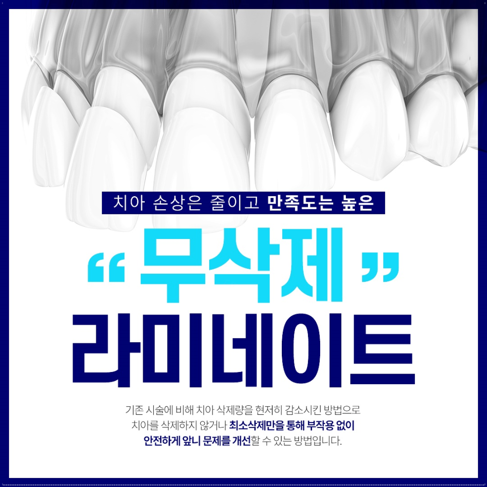 종로3가치과에서 알려드리는 무삭제 라미네이트 완벽 가이드 관련 이미지 6