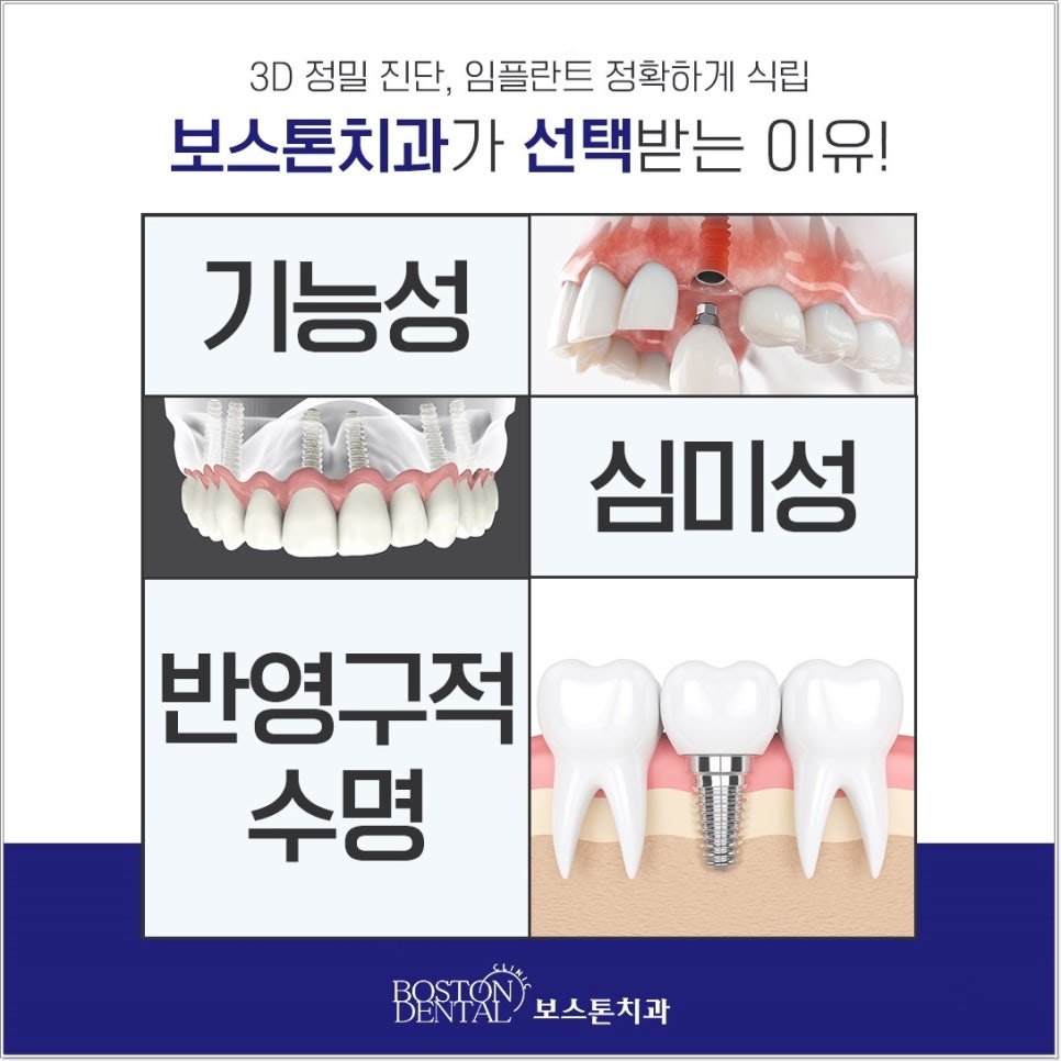 종로야간진료치과 임플란트 잘 마무리하려면? 관련 이미지 2