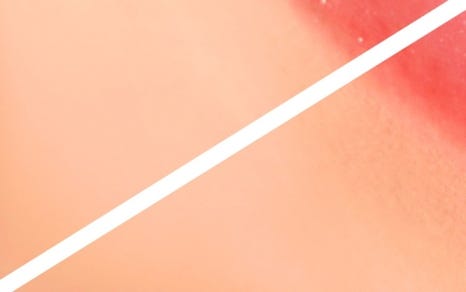 종로치과 치아미백 밝고 환하게 관련 이미지 22