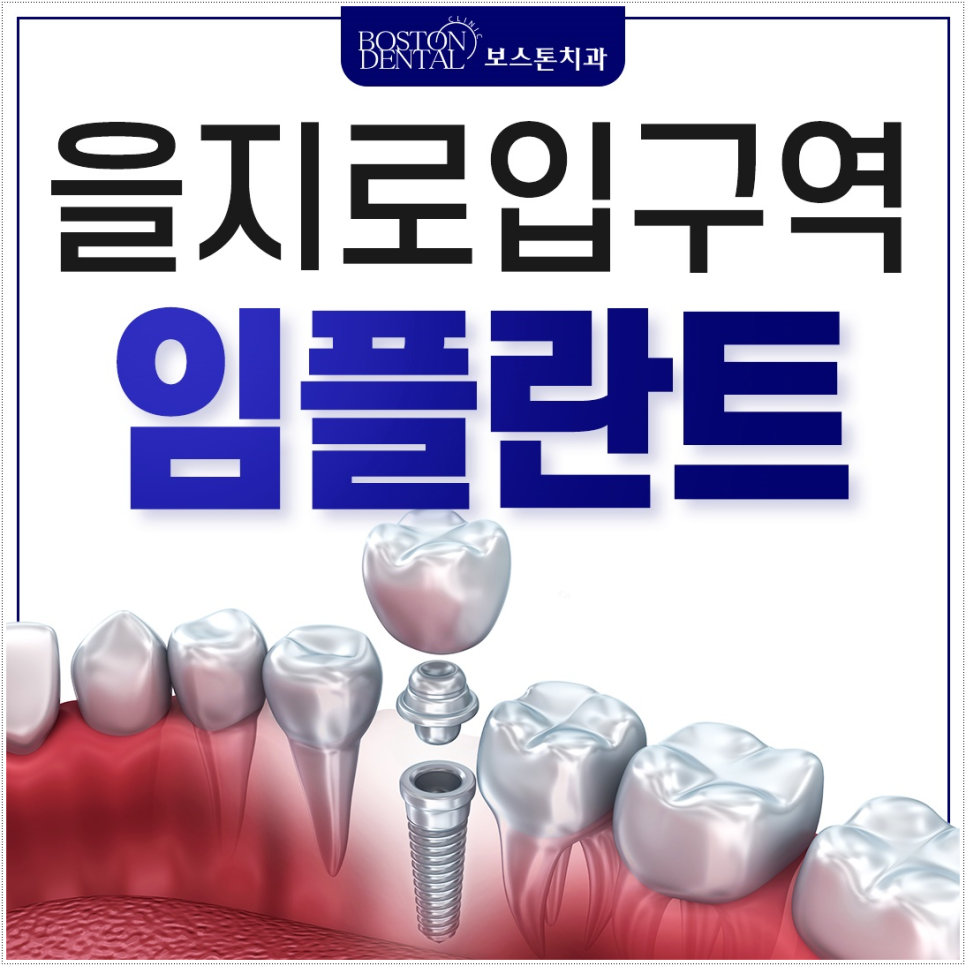 을지로입구역치과 잘 마무리하기 위해서는 관련 이미지 2