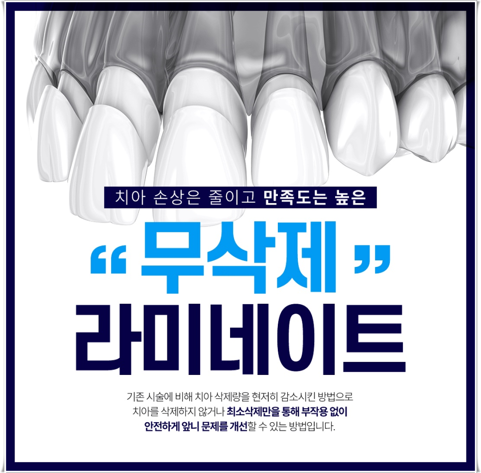 을지로입구역치과에서 알려드리는 치아미백과 라미네이트의 모든 것 관련 이미지 4
