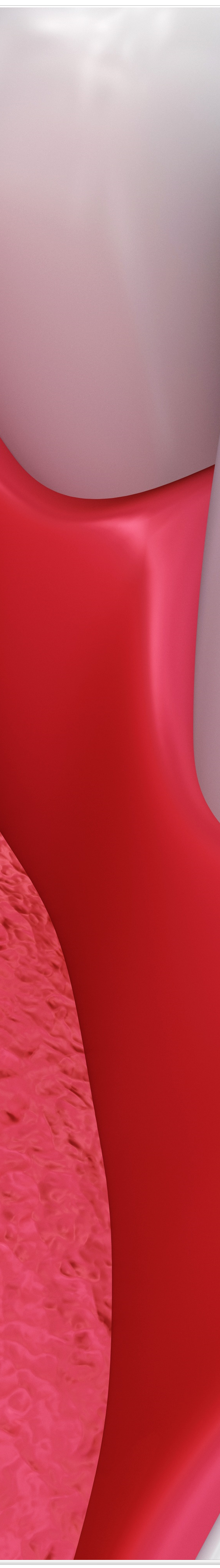 종로치과에서 알려드리는 치아미백과 라미네이트의 모든 것 관련 이미지 23